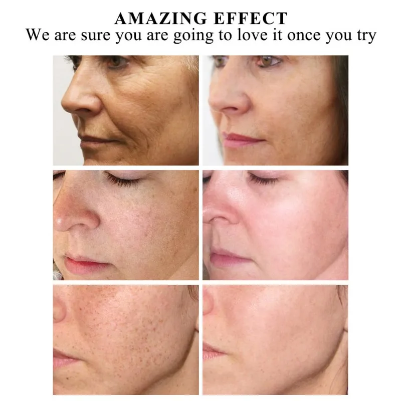 Rose Orange Firming Hyaluronic Acid Essential Oils Moisturizer Whitening Firming Facial Serum Anti-Aging Face Skin Care