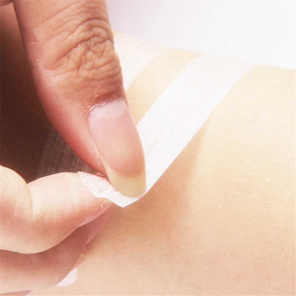 Medical Sterilized Tape, Seam-free Tape, Ventilated Caesarean Section, Skin Wound, Tensile Reduction, Sterile Tape
