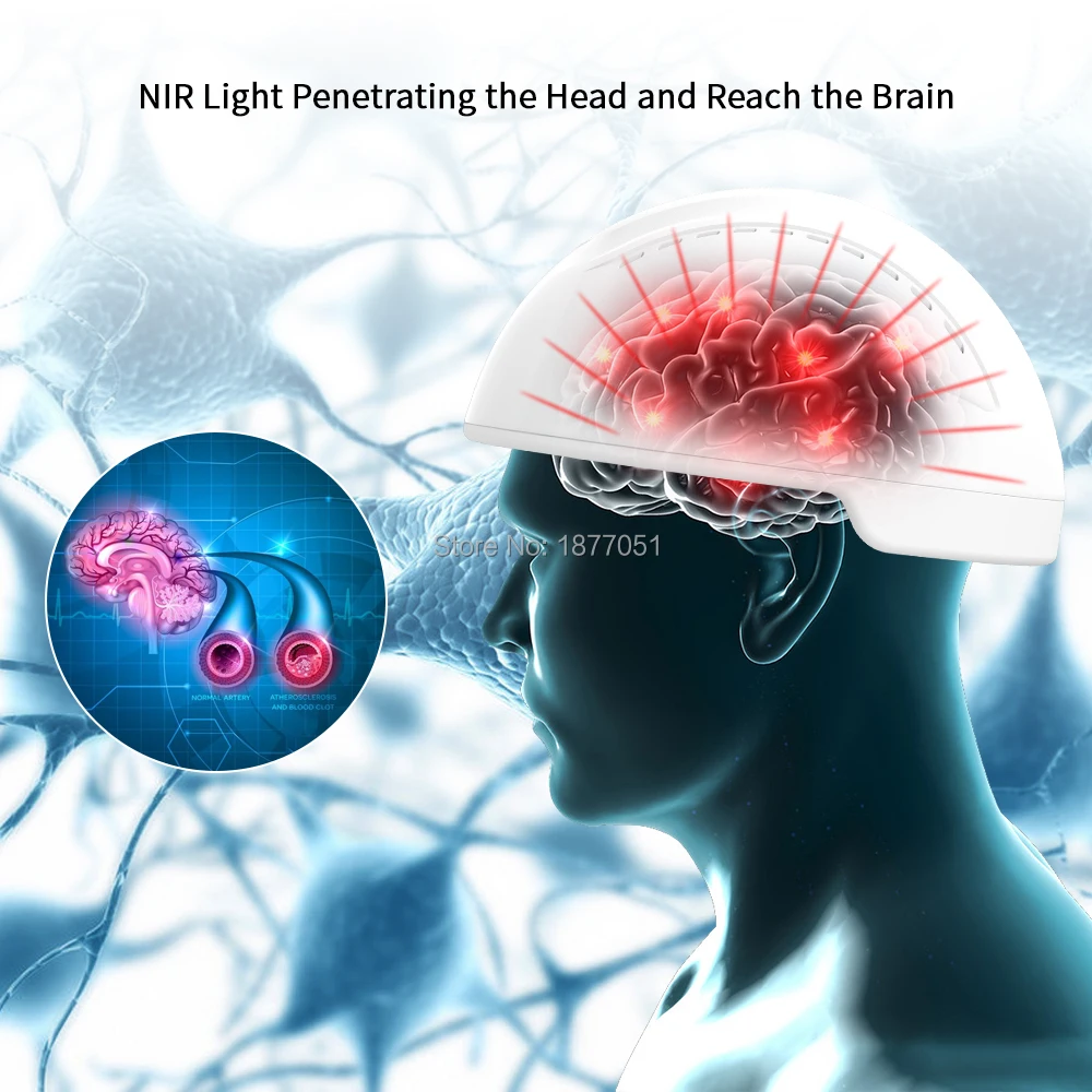 

SSCH 810nm NIR Brain photobiomodulation for enhancing cognition