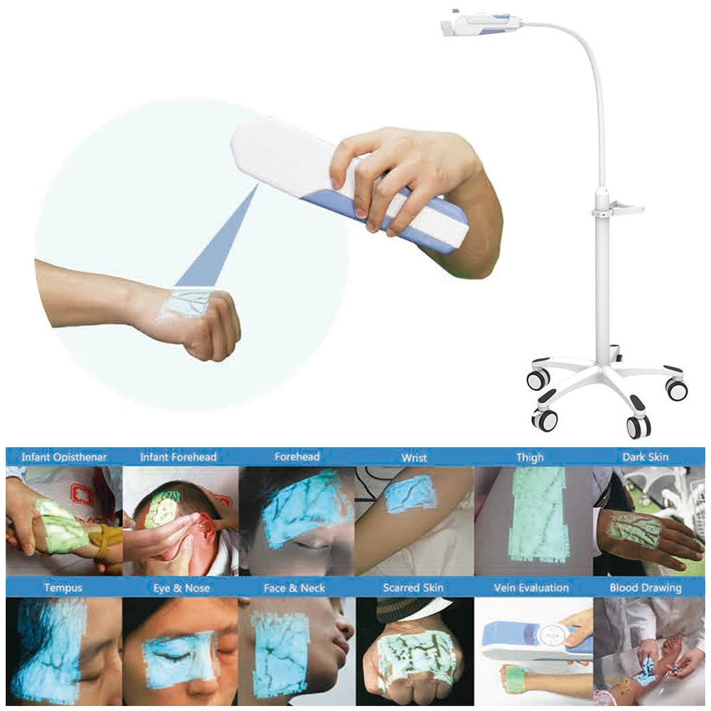 Больница Phlebotomy поиск трудных вен инфракрасная IV Детские вены просмотра цена