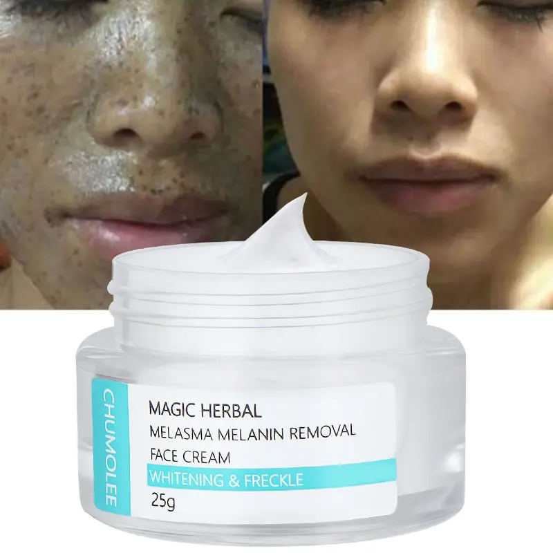 

CHUMOLEE Whitening Freckle Face Cream Moisturizing Remove Melasma Acne Dark Pigment Spots Melanin Pimple Brighten Day Cream