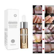 Модный раствор для ремонта ногтей, клей для восстановления ногтей, красота ногтей, Уход за ногтями, масло, предотвращающее появление лака для ногтей, питательный протектор для кожи