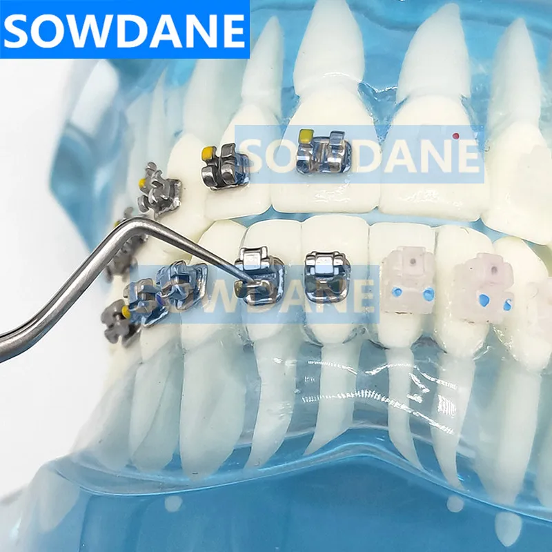 Dental Self-Ligating Bracket Opener Tool - Double-Ended Stainless Steel Orthodontic Instrument