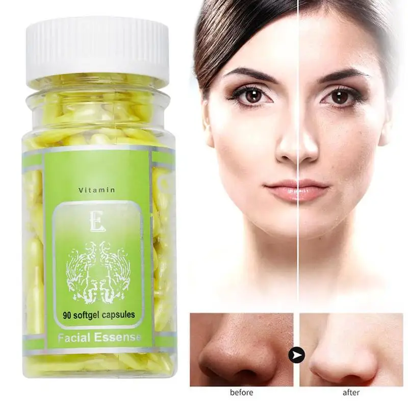 Kalmerend Rimpelingen Netelig Vitamine E Capsules Hydraterende Voeding Whitening Crème Ve Huid Sproet  Serum Spot Acne Verwijderen Capsule 90Pcs/Fles|Serum| - AliExpress