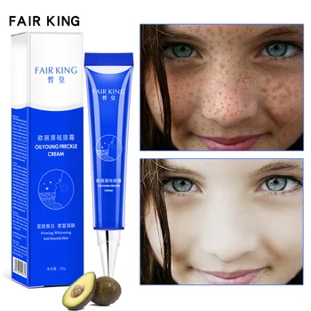 

Powerful Whitening Freckle Cream Remove Melasma Acne Spots Face Lift Firming Pigment Melanin Dark SpotsFace Care Cream TSLM1