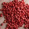 Automatic Peanut Nut Sheller Peanut Peeling Machine 6
