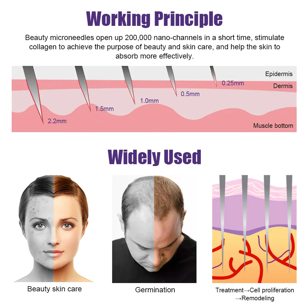 Natural Men Beard Growth Derma Roller DRS 540 Micro Needle Dermaroller Hair Regrowth Anti Hair Loss Treatment 0.2/0.25/0.3mm derma roller