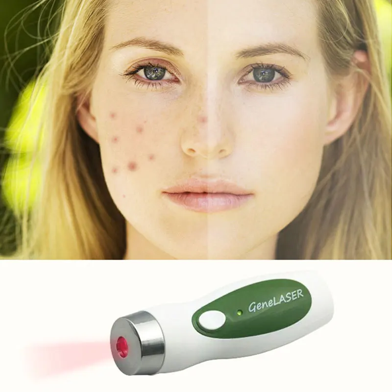 

Electric LED beauty equipment acne instrument facial detoxification instrument fade acne acne