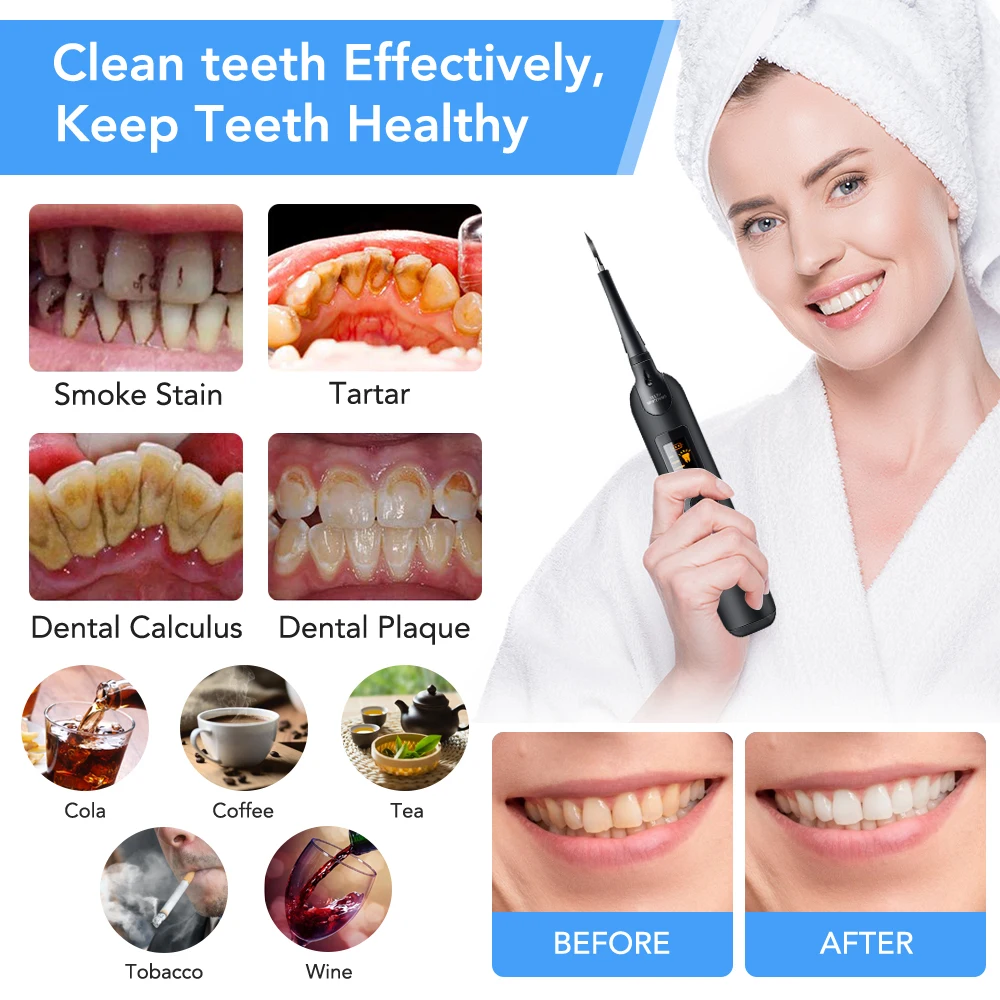 Tooth Dental Calculus Remover Vibration Sonic Scaler Professional Teeth Stains Removal Tool