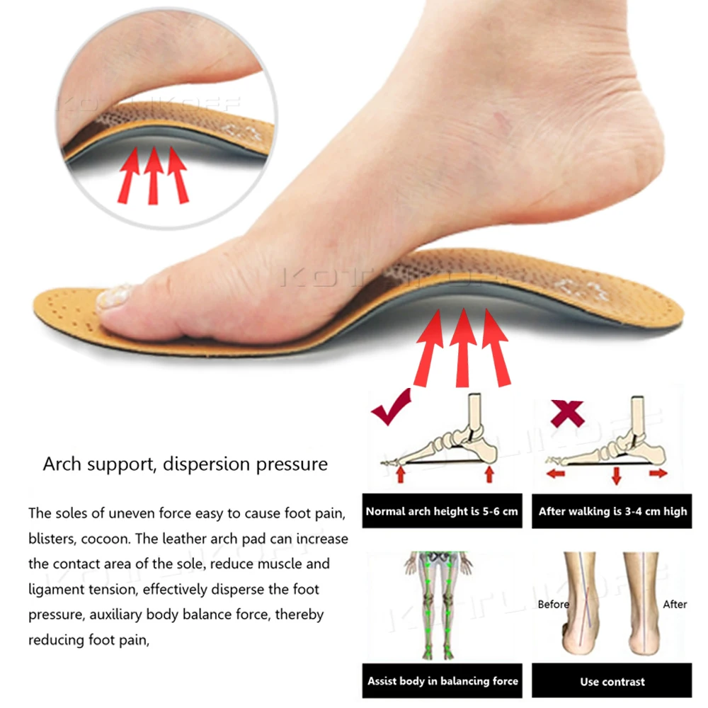 Flat Feet Insoles For Bad Feet Flat Feet Arch Support X/O Legs - Main Image