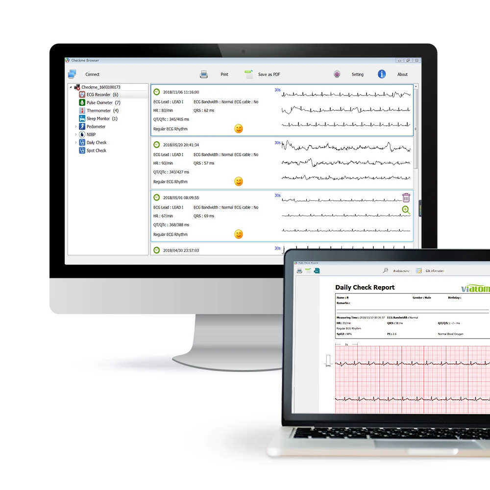 Portable Vital Signs Monitor with APP & PC Report ECG/EKG Monitor Pulse Oximeter Viatom Checkme Lit
