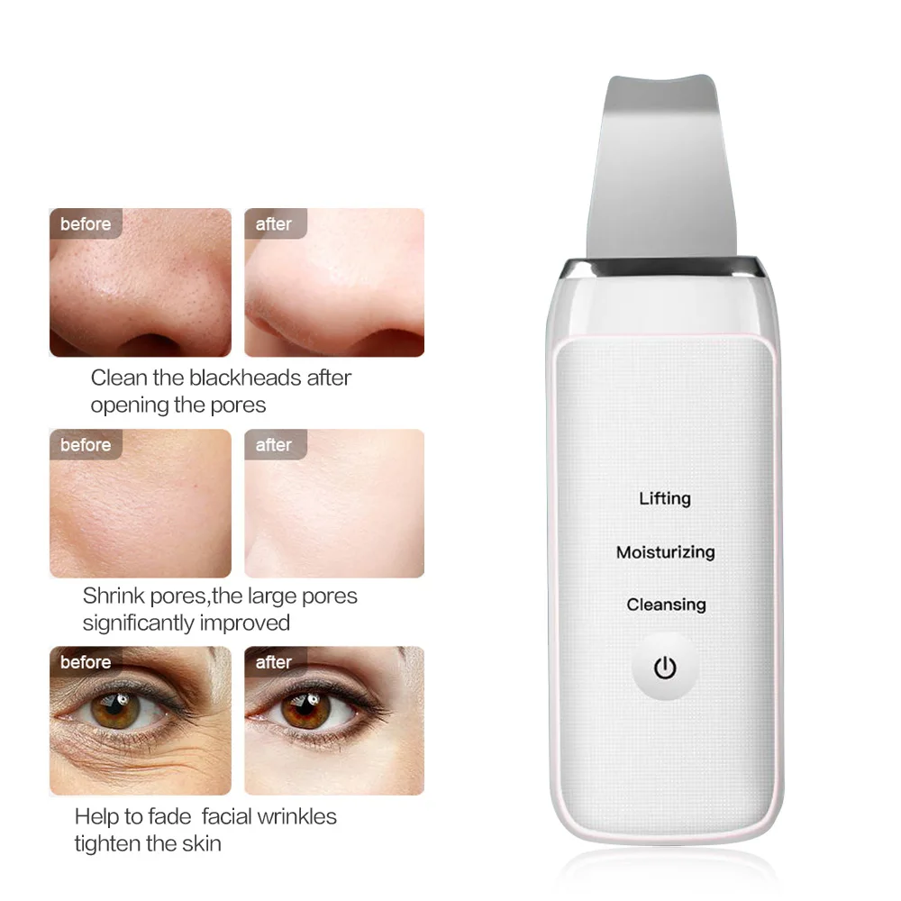 

Ultrasonic Deep Face Cleaning Machine Ultrasonic Face Skin Scrubber Facial Cleaner Vibration Blackhead Removal Exfoliating Pore