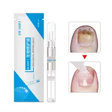 3 мл ручка для ногтей пальцы ног ногти лечебный травяной жидкий уход за косметикой для Onychomycosis Paronychia лечение инфекции