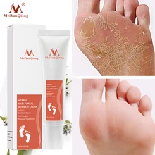 

MeiYanQiong Feet Care Smelly Sweaty Itching Ointment Chinese Medicine Useful Itching Ointment Foot Cream Foot Odor Treatmen 15ml