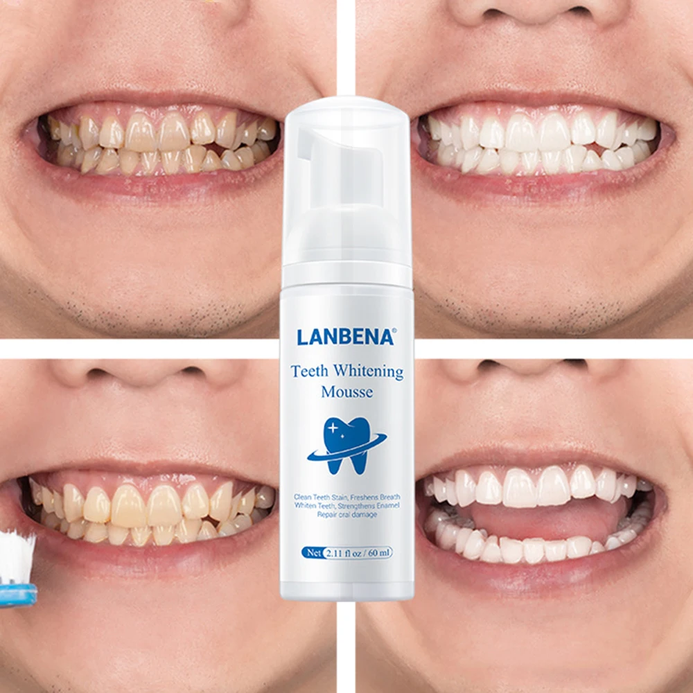 

Teeth Whitening Mousse Tooth Whitening Cleaning White Teeth Oral Hygiene Toothpaste Bleaching Remove Stains Dental Tool