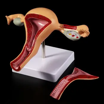 

Human Pathological Uterus Ovary Model Anatomical Anatomy Disease Pathology Lesion For Teaching H55F