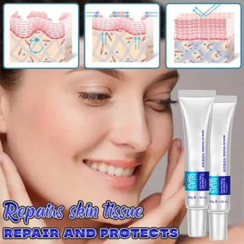 

Hot Skin Anti-Blemish Cream Minimize Acne Marks Age Spots Brighten Skin Tone Firming Skin t6