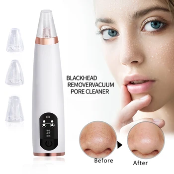 

Blackhead Remover Vacuum Electric Blackheads Vacuum Suction Acne Black Head Remover Pore Vacuum Cleaner Blackhead Extractor