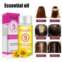High Quality 20ml Hair Growth Thick Essential Oil Hair Scalp Care Treatment for Men Women