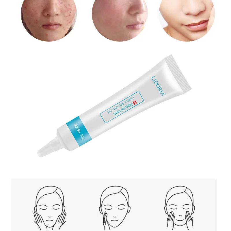 Акне контроль. Акне контроль. Acne control крем. Атоми акне эксперт набор. Acne control bb крем точечного нанесения корректирующий 5 мл , 5 мл.