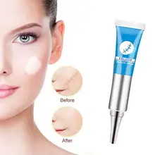 eelhoe scar removal cream