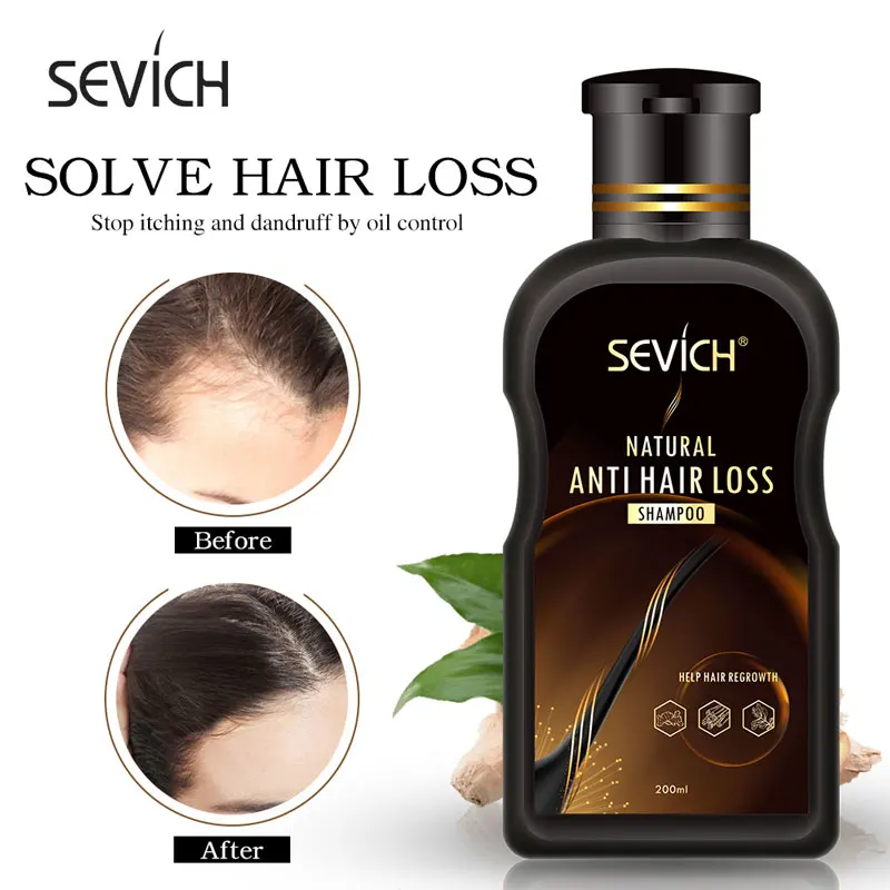 thumbnail image 1 of Champú instantáneo para cabello negro Sevich, 10 unidades por lote, oscurece el cabello gris y blanco y lo deja brillante en 5 minutos. Champú para teñir el cabello., 1 of 5