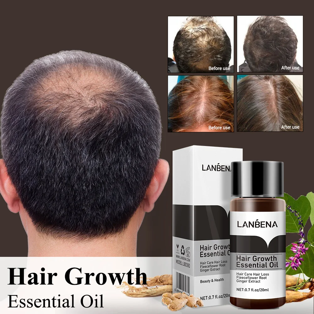LANBENA Ginger Fast Powerful эфирное масло для роста волос продукты лечения и предотвращения