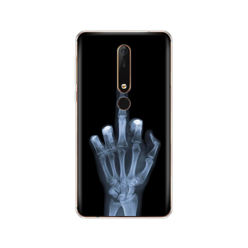 Силиконовый чехол для Nokia 6 1 7 plus 8 9 2018x5x6 мягкая задняя крышка телефона из ТПУ