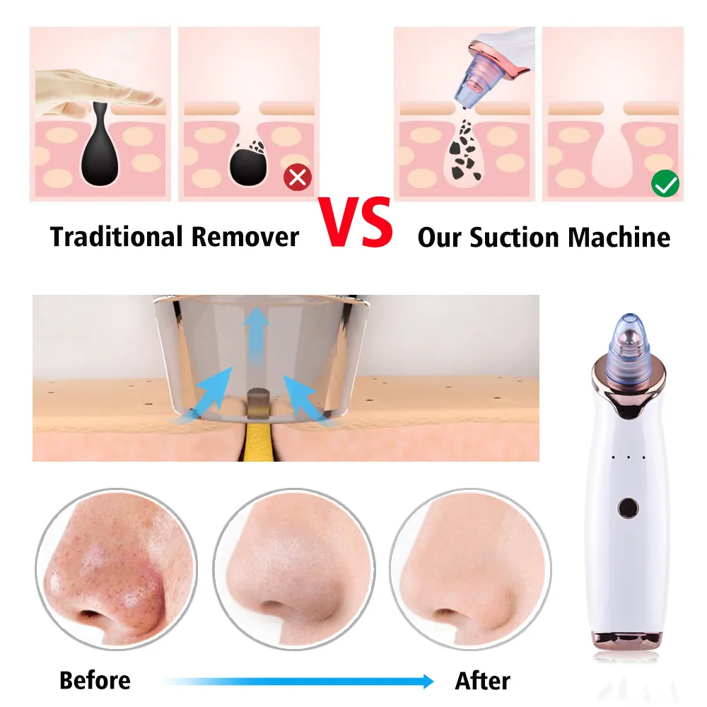 

Electric Acne Remover Point Noir Blackhead Vacuum Extractor Tool Black Spots Pore Cleaner Skin Care Facial Pore Cleaner Machine
