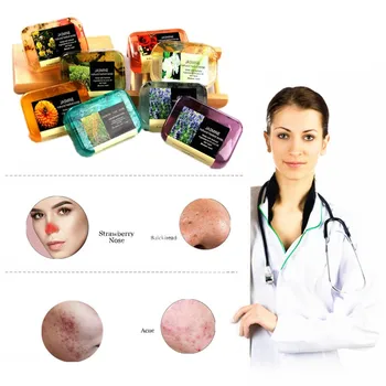 

Anti Freckles Essential Whitening Skin Soap Make Skin Smooth Soap Face Care Wash Basis Soap Removal Pimple Pore Acne Treatment