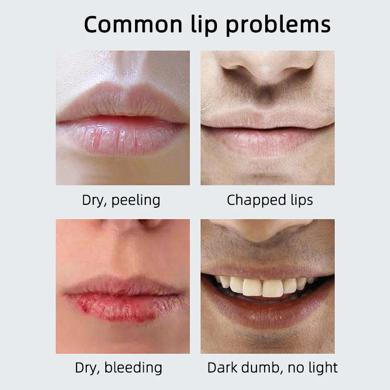 Увлажняющая сухая Обветренная губная помада для мужчин, восстанавливающая треснутые губы
