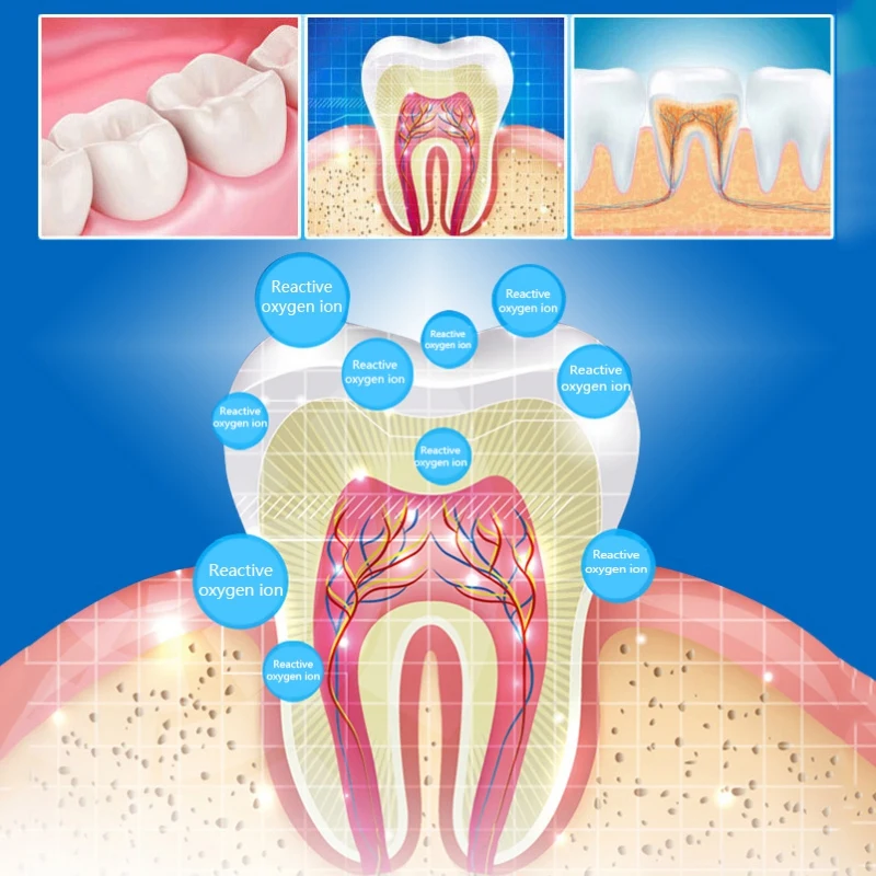 Tooth Paste to Yellow Teeth Dirty Teeth Whitening Whitening Tooth Paste Teeth Set