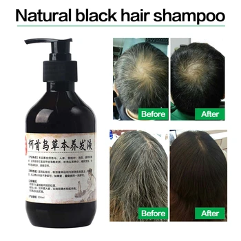 

Herbal Natural Polygonum Multiflorum Shampoo Plant Liquid Grey Hair White Hair Removal Turn Permanent Black Hair Care 300ml