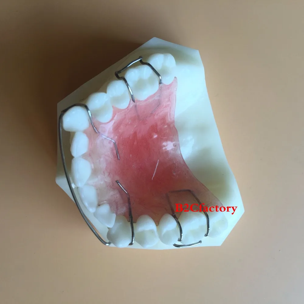 Стоматологическая модель фиксатора Hawley для обучения зубов Модель 3007 01|teeth model|dental