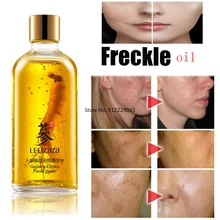 

100ML Ginseng Essence Freckle Removing Whitening Serums Remove Melasma Water Firming Moisturizing Repairing Anti-Aging Brighten