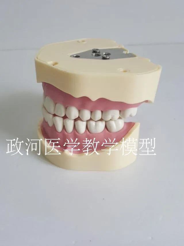 

Dental model Gingival Oral Detachable free shipping