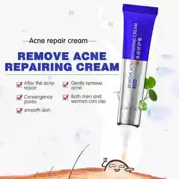 

Acne Treatment Cream 20ml Oil Control Shrink Pores Moisturizer Face Care Cream Convergence Pores Relieve Acne