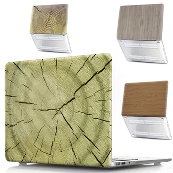 

Full Protective For Huawei Matebook D 14 D 15 2020 Honor MagicBook 14 15 Hard PVC Case For Matebook 13 14 X Pro 13.9 Inch Retail