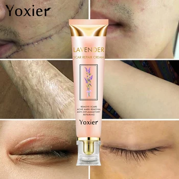 

Yoxier Repair Scar Cream Acne Scar Stretch Marks Pigmentation Corrector Anti-allergic Calm Whitening Skin Care Face Cream 3pcs