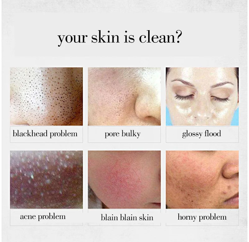 Charcoal Face Cleansing Soap Face Cleaner Cleaning Face Wash Remove Blackhead Shrink Pores Acne Treatment Whitening 1 Charcoal Face Cleansing Soap Face Cleaner Cleaning Face Wash Remove Blackhead Shrink Pores Acne Treatment Whitening 3