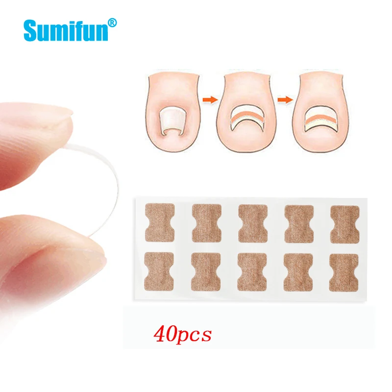 Toenail Correction Patch 40pcs Paronychia Treatment Pedicure Orthodontic Toe Thumb Sticker Finger Glue Ingrown Patch