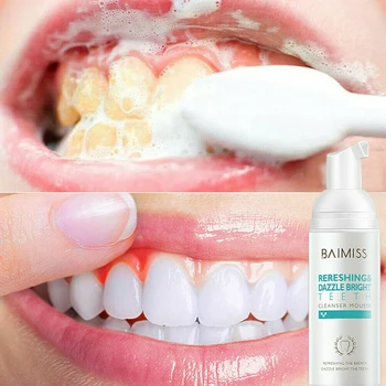 

Hot Teeth Whitening Mousse Remove Stains Tooth Cleaning White Teeth Oral Hygiene Toothpaste Bleaching Dental Tool Teeth Care