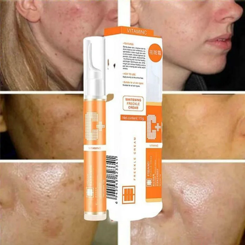 15ML Freckle Remover Gel Vitamin C Whitening Anti-Freckle Cream Pencil to effectively remove stains and freckles 15ML Freckle Remover Gel Vitamin C Whitening Anti-Freckle Cream Pencil to effectively remove stains and freckles