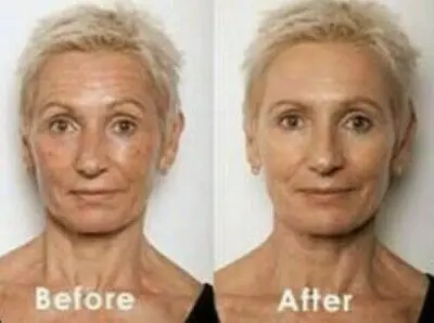 PURE RETINOL витамин а ARBUTIN Matrixyl 3000 против морщин сыворотка для лица 35 мл. Бесплатная