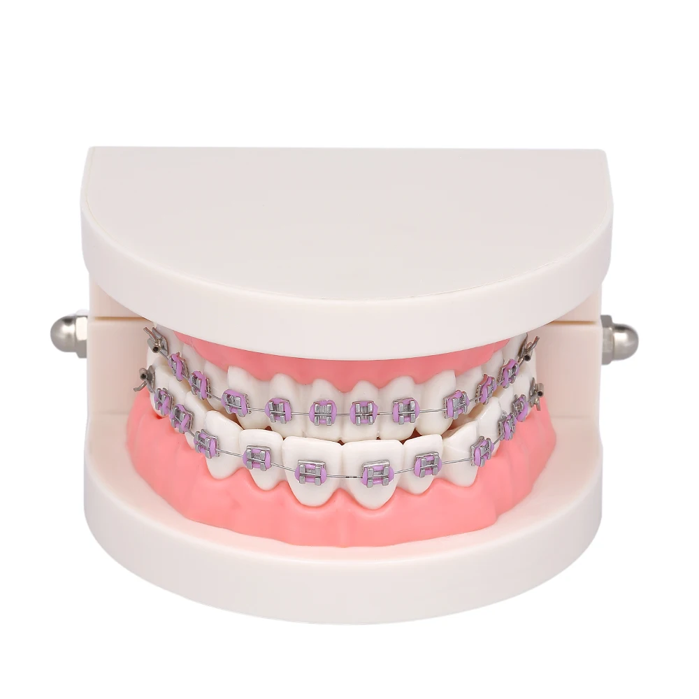 

Dental Orthodontic Mallocclusion Model Tube Teeth Model with Brackets Archwire Buccal for Patient Communication Adult Teaching