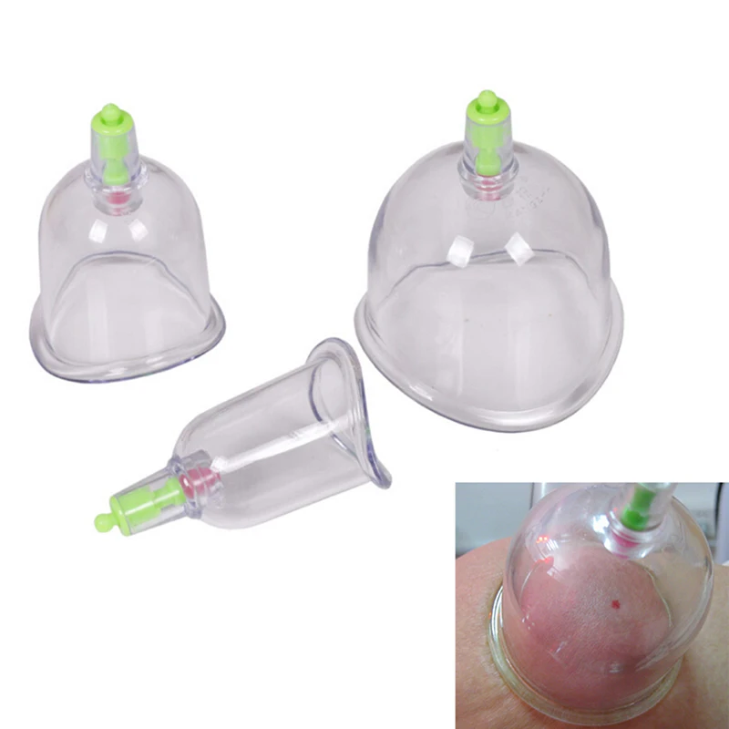 3PCS/Set Traditional Chinese Cupping U Curved Vacuum Cupping Suction Joint Cupping Therapy Joints Cups Acupuncture Massage