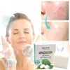 100g Silk Protein Skin Repair Facial Cleaning Soap Remove Mites Blackheads Handmade Soap Oil Control Bath Use Skin Care