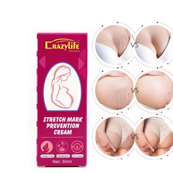 

30g Stretch Mark Repair Cream Postpartum Care For Pregnant Women Firming Skin