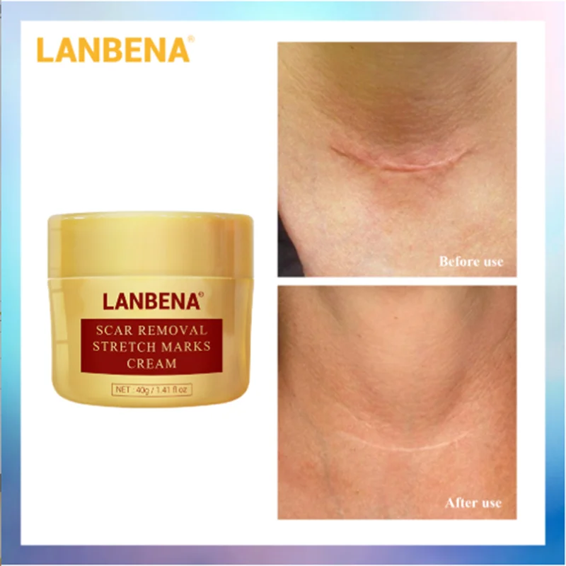 LANBENA крем для удаления шрамов удаление черных точек сужение пор отбеливание