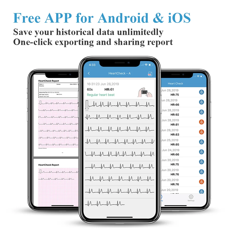 ECG/EKG Heart Monitor for Arrhythmia Afib 30s5min Measurement Support